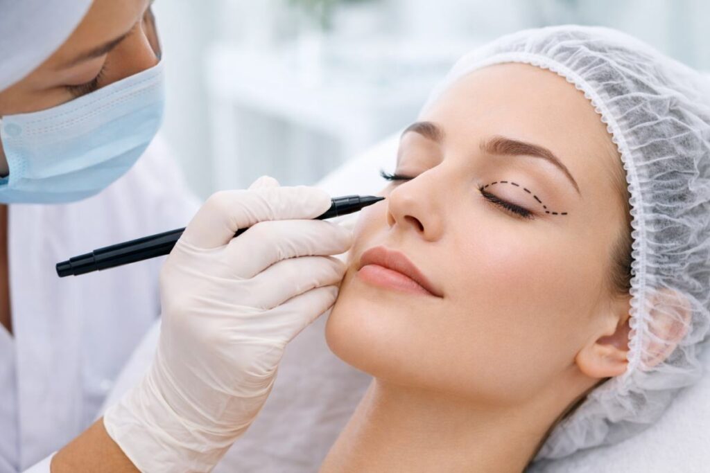 blefaroplastica clinicare