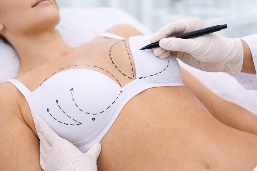 reduccion de pecho clinicare